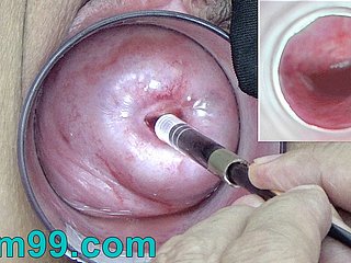 膣に子宮頸管カム内部の日本内視鏡カメラ